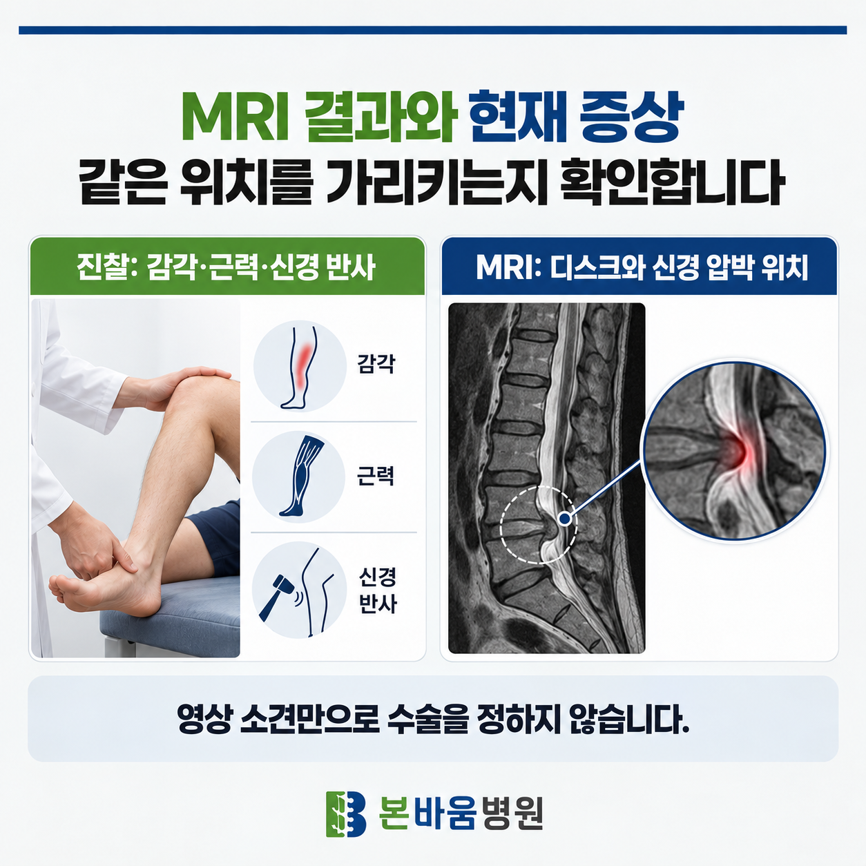 615d57dc6bfc84416f61d25eac82b614_1791942083_2688.png 진찰과 MRI로 신경 압박의 위치를 살핍니다