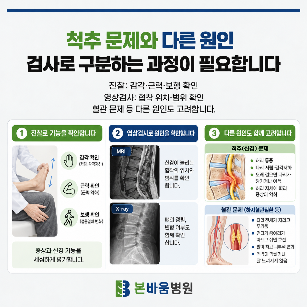 615d57dc6bfc84416f61d25eac82b614_1791942113_0275.png 좁아진 부위와 현재 증상이 맞는지 검사합니다
