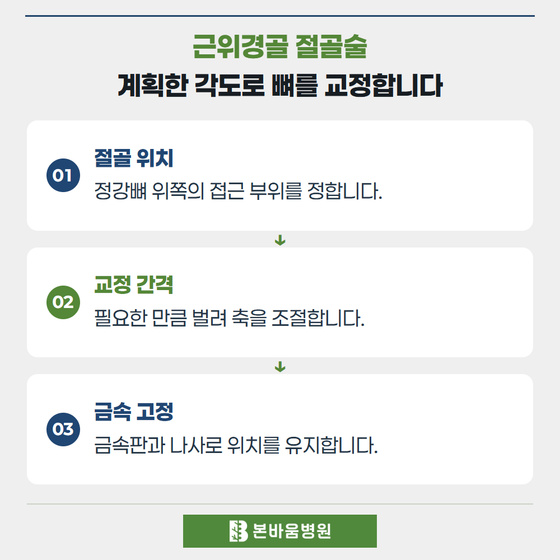 은평구정형외과 절골 위치 · 교정 간격 · 금속 고정 — 근위경골 절골술 · 계획한 각도로 뼈를 교정합니다