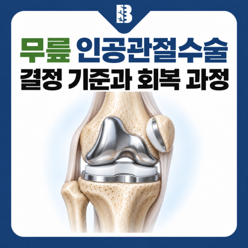 은평구정형외과 인공관절수술, 결정 기준부터 맞춤형 수술과 재활까지
