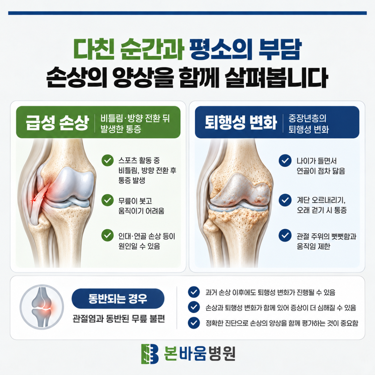 은평구정형외과 반월상연골의 급성 손상과 퇴행성 변화를 비교하는 그림