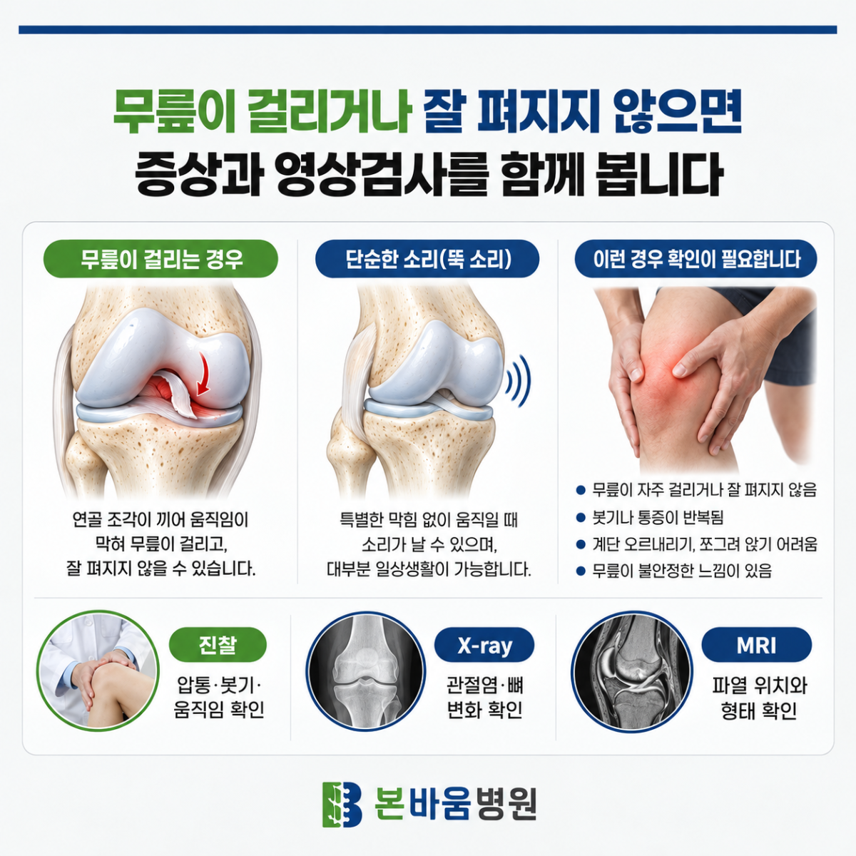 은평구정형외과 무릎 잠김·소리·통증을 구분하고 진찰·엑스레이·MRI를 설명하는 안내