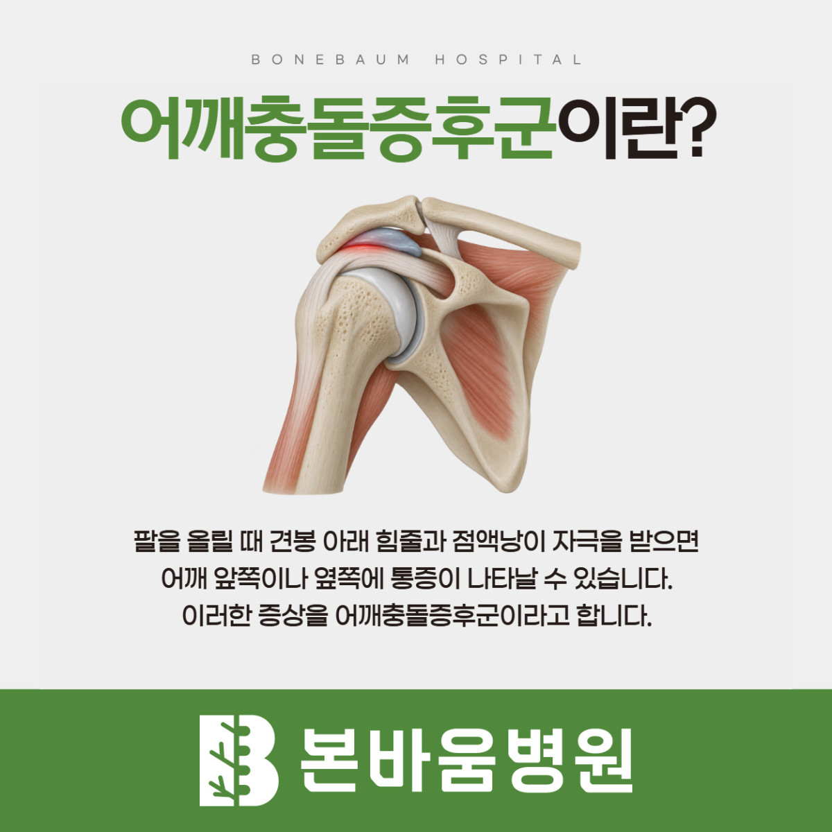 은평구정형외과 견봉 아래 힘줄과 점액낭 부위를 보여주는 어깨충돌증후군 설명 그림